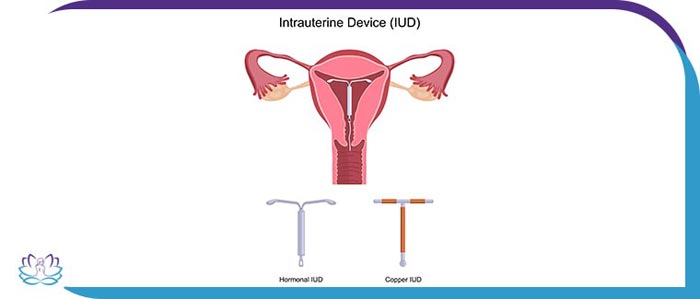 Contraception and IUD Birth Control Specialist in Chicago, IL