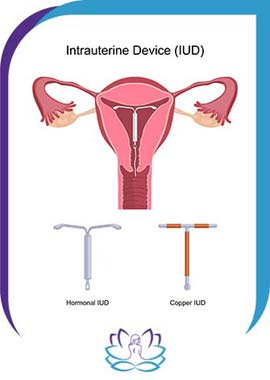 IUD/contraceptive options - Michelle Trandai MD in Chicago, IL